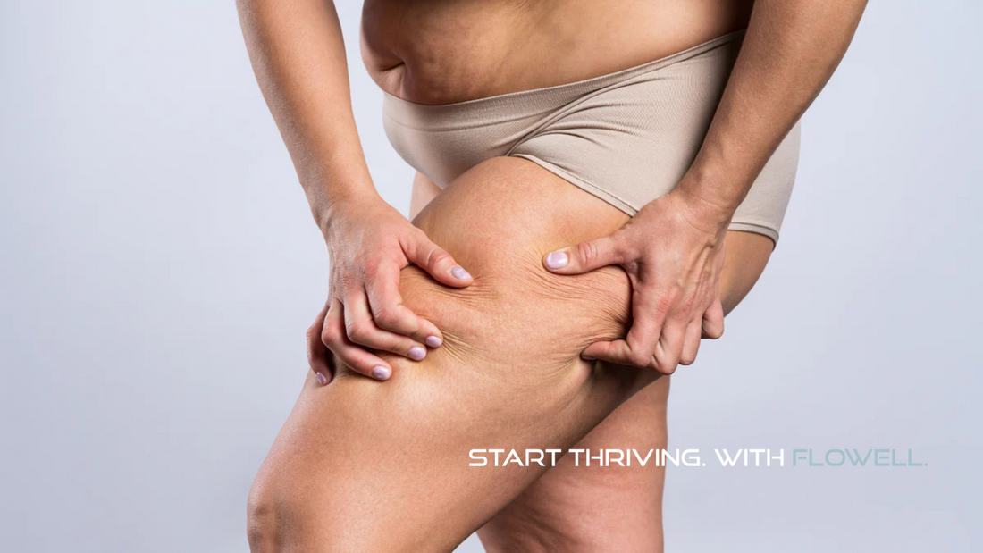 Diagnosed with Lipedema - what now?