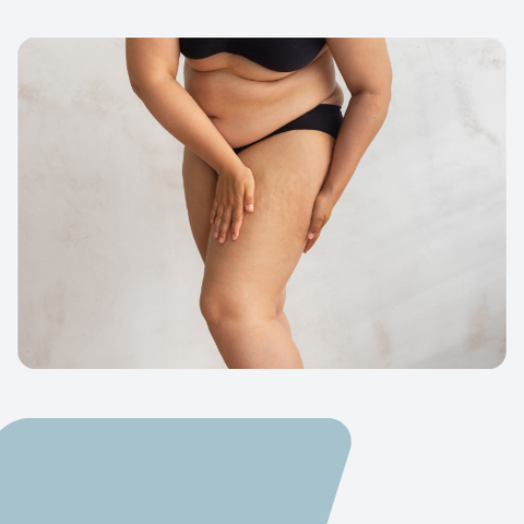 Flowell - Woman in underwear examining her heavy legs